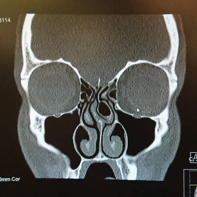 img_20190124_174326_275